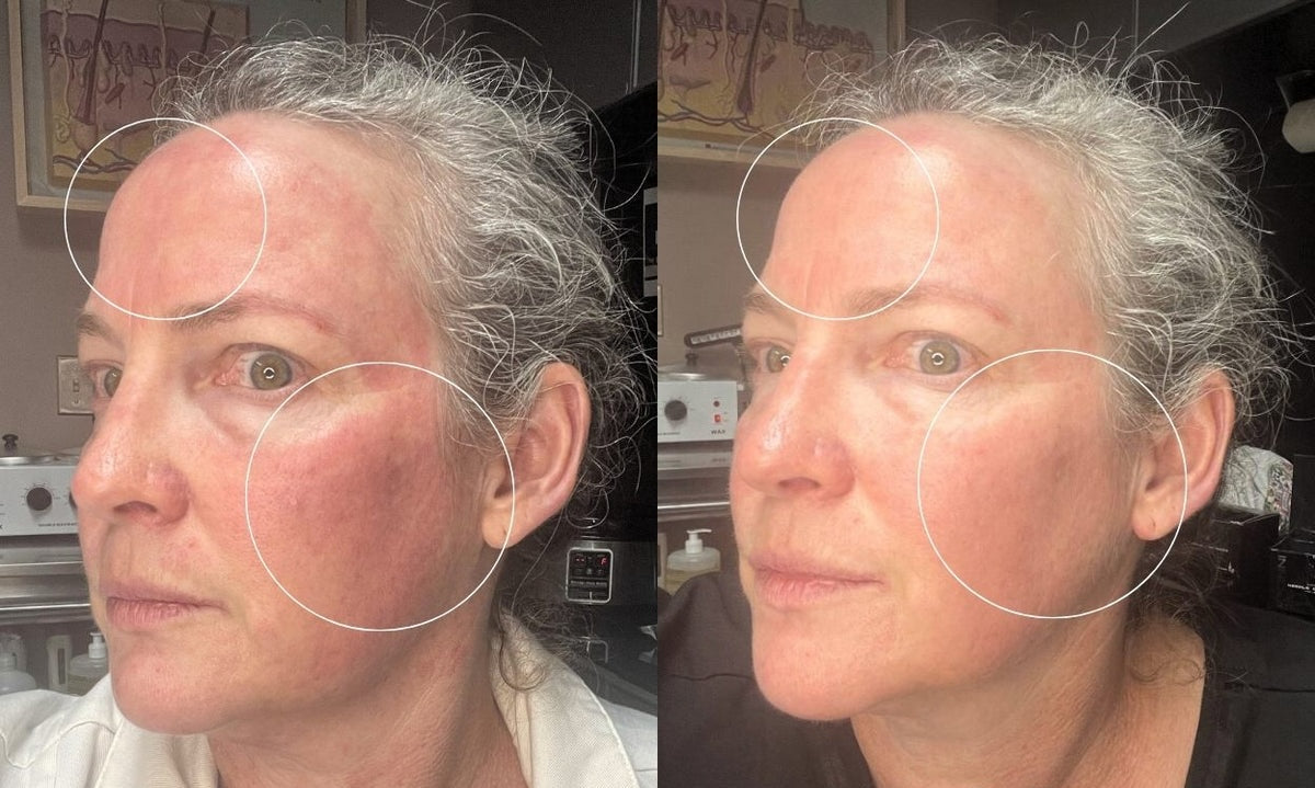 Calmer redness, more even tone